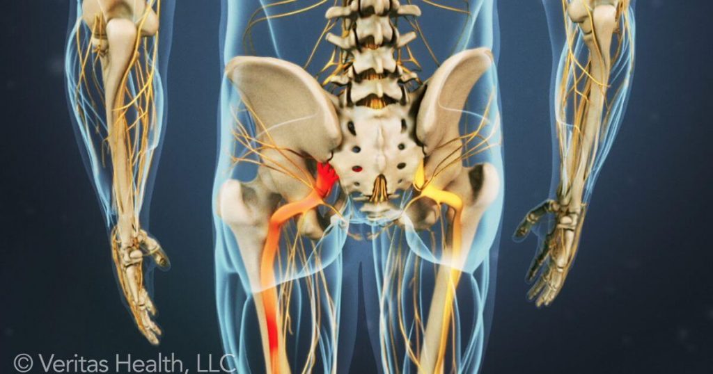 Benefits of Chiropractic Care for Sciatica